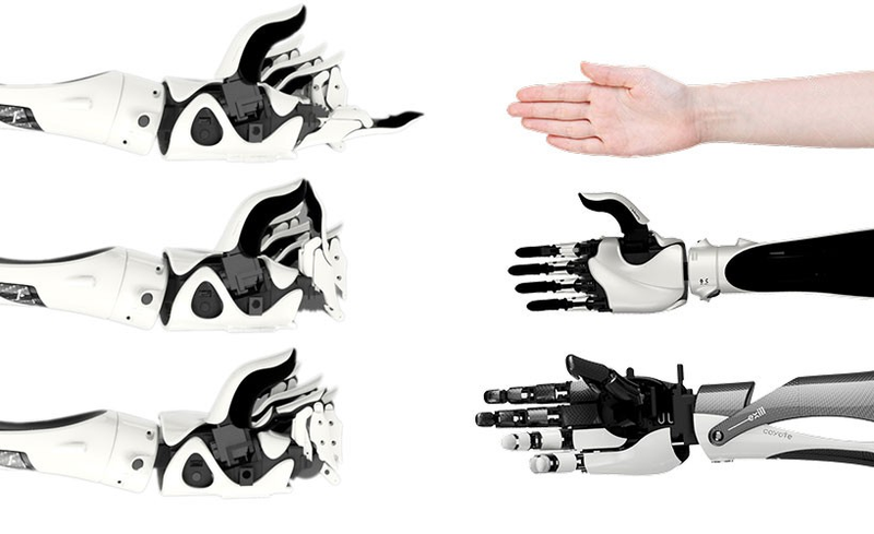 Illustration for article titled Open-Source Cyborg Hand is Making Prosthetics More Accessible Than Ever